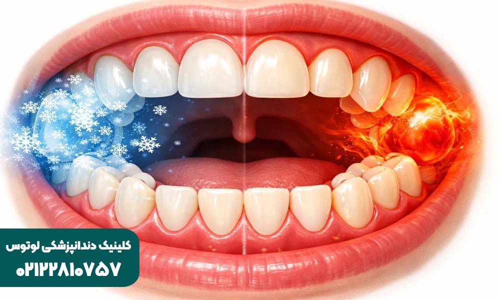 حساسیت دندان به سرد و گرم شدن