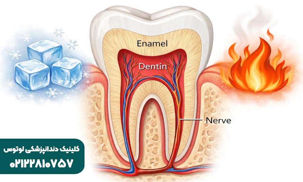 حساسیت شدید دندان به سرد شدن