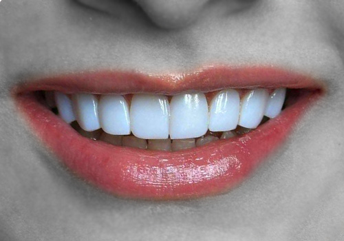 دسته بندی نمونه کارهای کامپوزیت