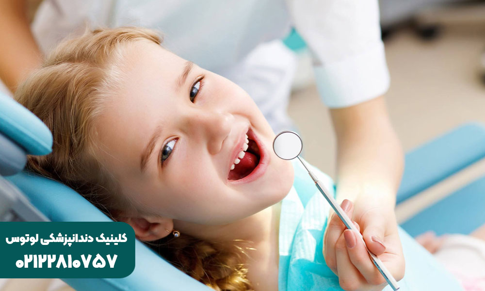فلورایدتراپی دندان کودکان