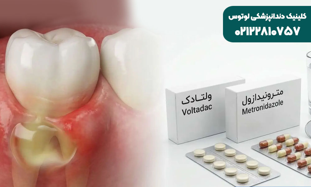 بهترین قرص دندان درد شدید چیست؟